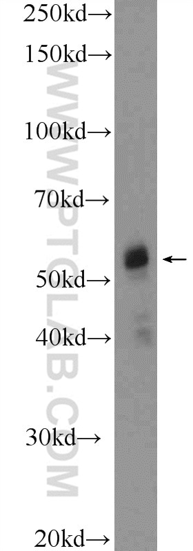 Western Blot (WB) analysis of human testis tissue using DAZ4 Polyclonal antibody (14065-1-AP)