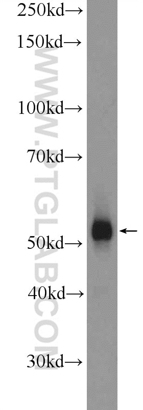 Western Blot (WB) analysis of mouse testis tissue using DAZ4 Polyclonal antibody (14065-1-AP)