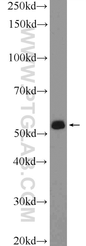 Western Blot (WB) analysis of rat testis tissue using DAZ4 Polyclonal antibody (14065-1-AP)