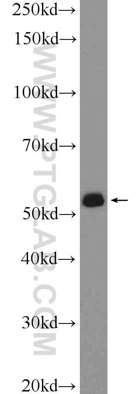 WB analysis of rat testis using 14065-1-AP