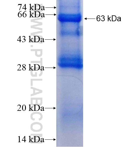 DAZ4 fusion protein Ag5116 SDS-PAGE