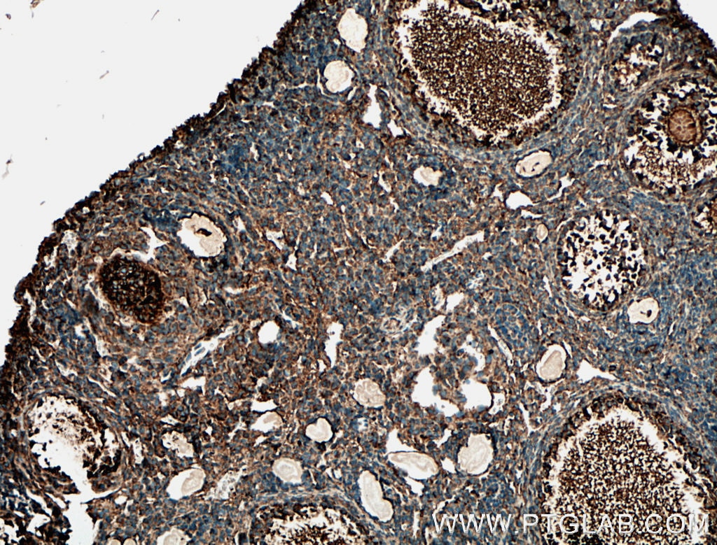 Immunohistochemistry (IHC) staining of mouse ovary tissue using DAZL Polyclonal antibody (12633-1-AP)