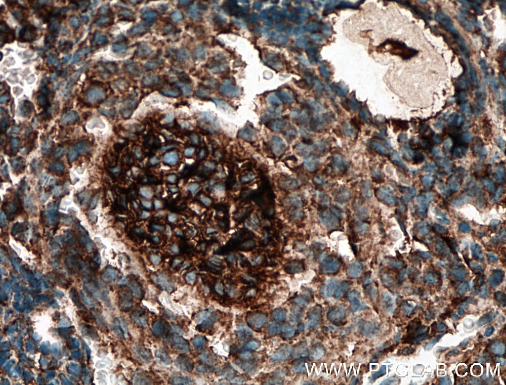 IHC staining of mouse ovary using 12633-1-AP