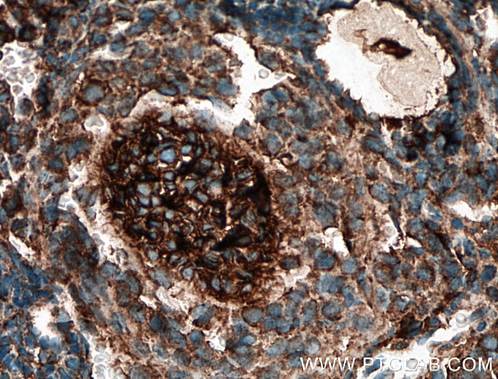 Immunohistochemistry (IHC) staining of mouse ovary tissue using DAZL Polyclonal antibody (12633-1-AP)