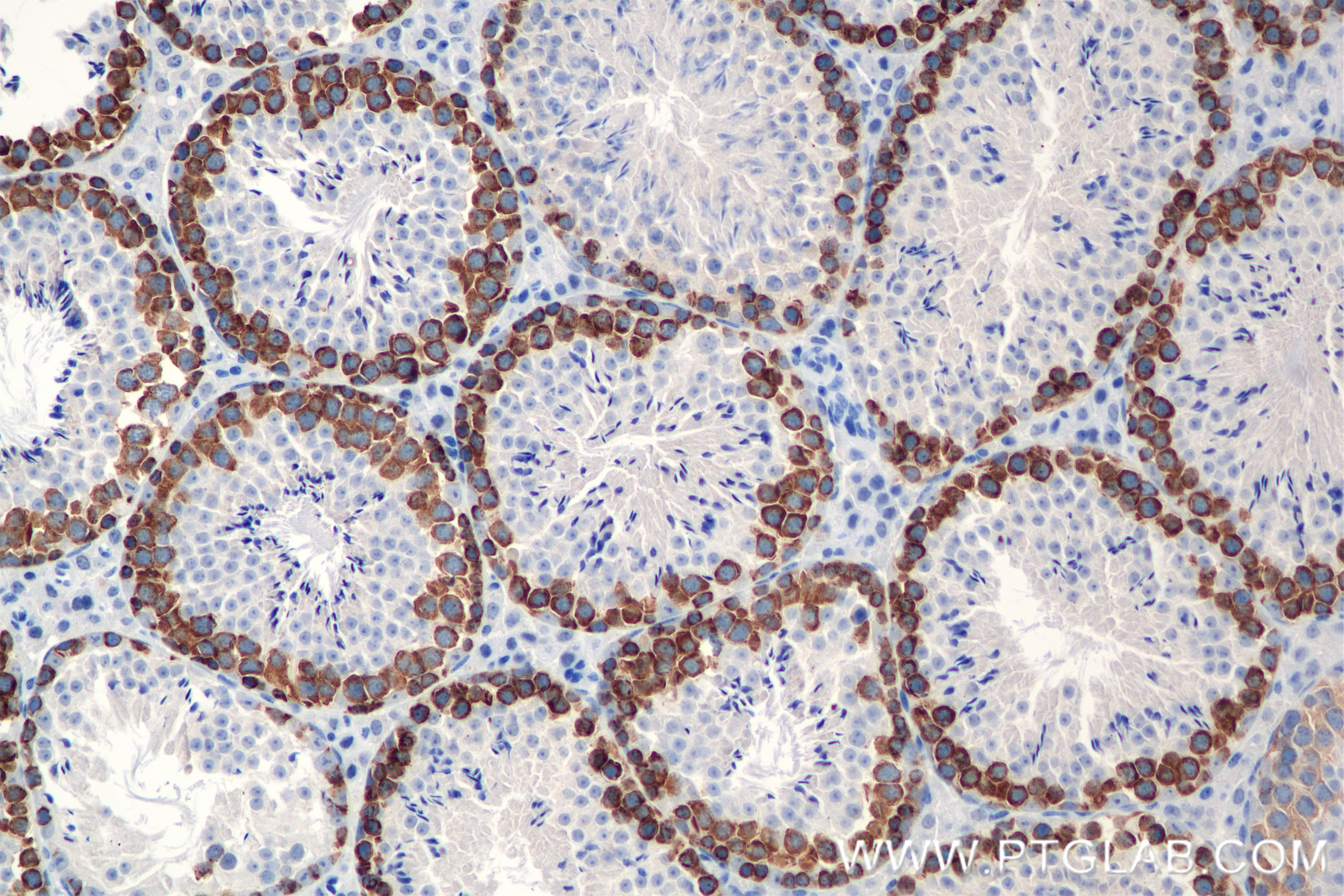 Immunohistochemistry (IHC) staining of mouse testis tissue using DAZL Recombinant antibody (86344-3-RR)