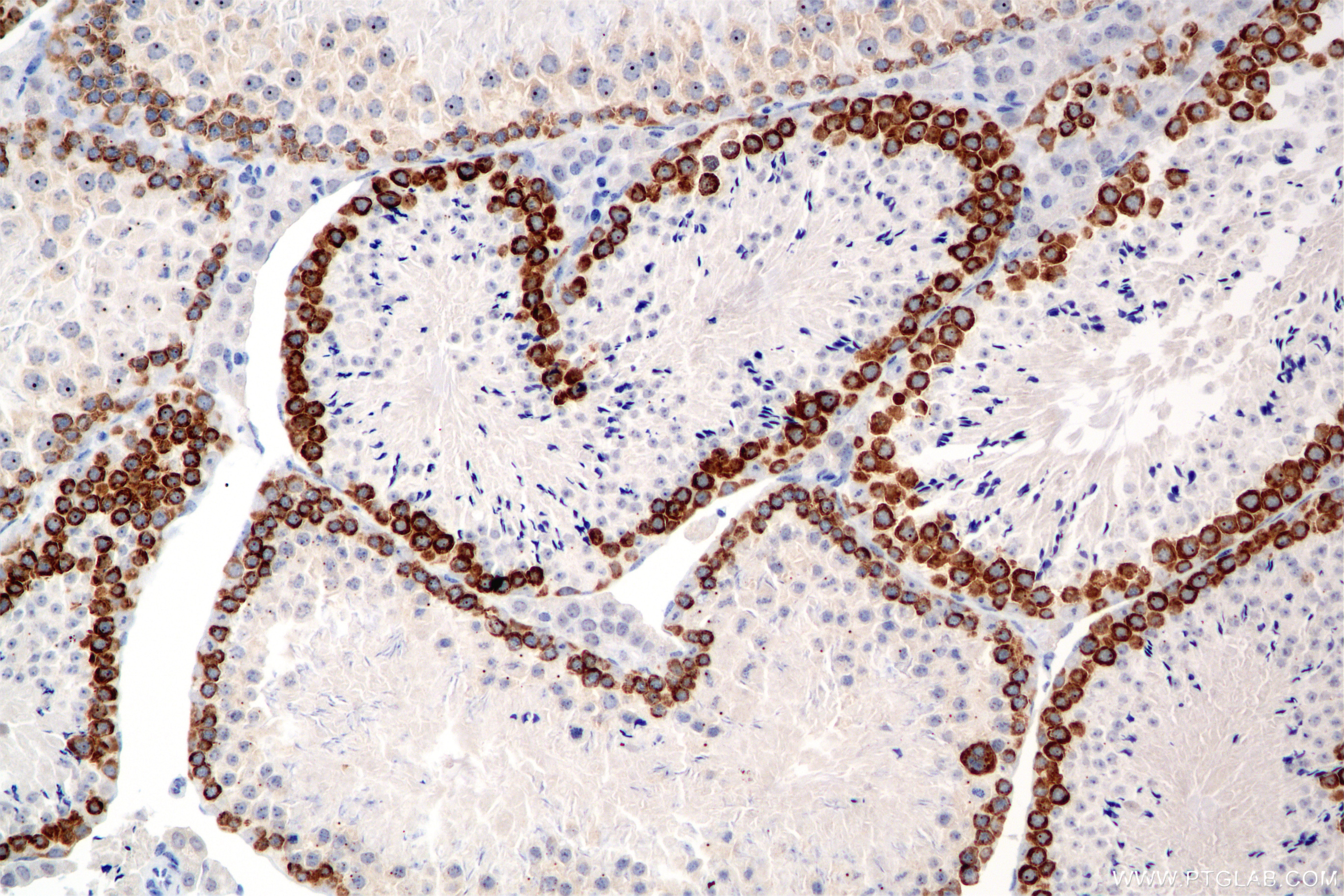 Immunohistochemistry (IHC) staining of mouse testis tissue using DAZL Recombinant antibody (86344-3-RR)