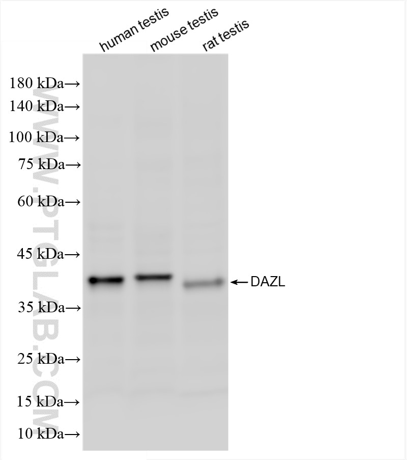 Western Blot (WB) analysis of various lysates using DAZL Recombinant antibody (86344-3-RR)