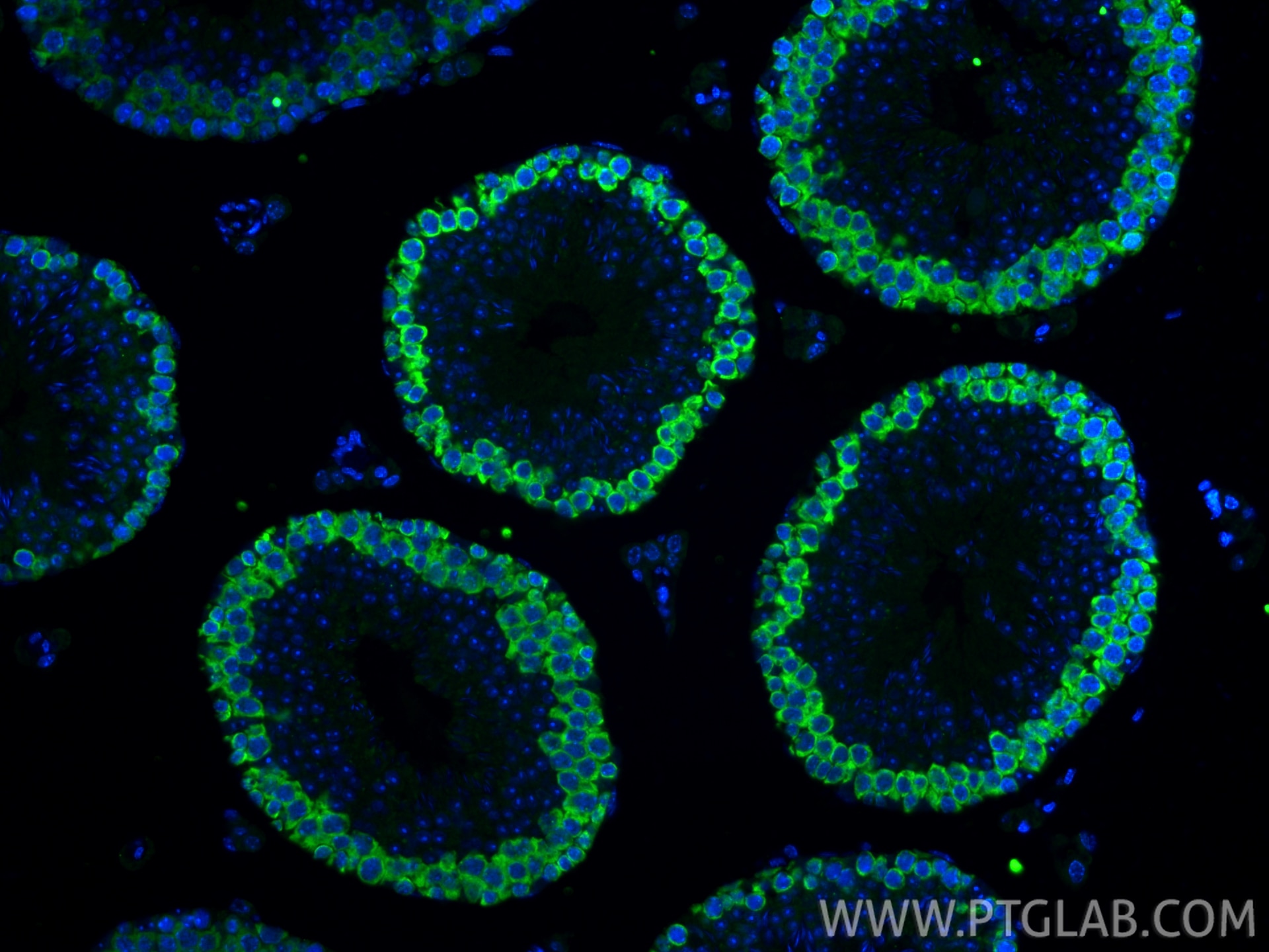 IF Staining of mouse testis using RMX00077 Immunofluorescence (IF) / fluorescent staining of mouse testis tissue using Multi-rAb® DAZL Multi-Recombinant antibody (RMX00077)