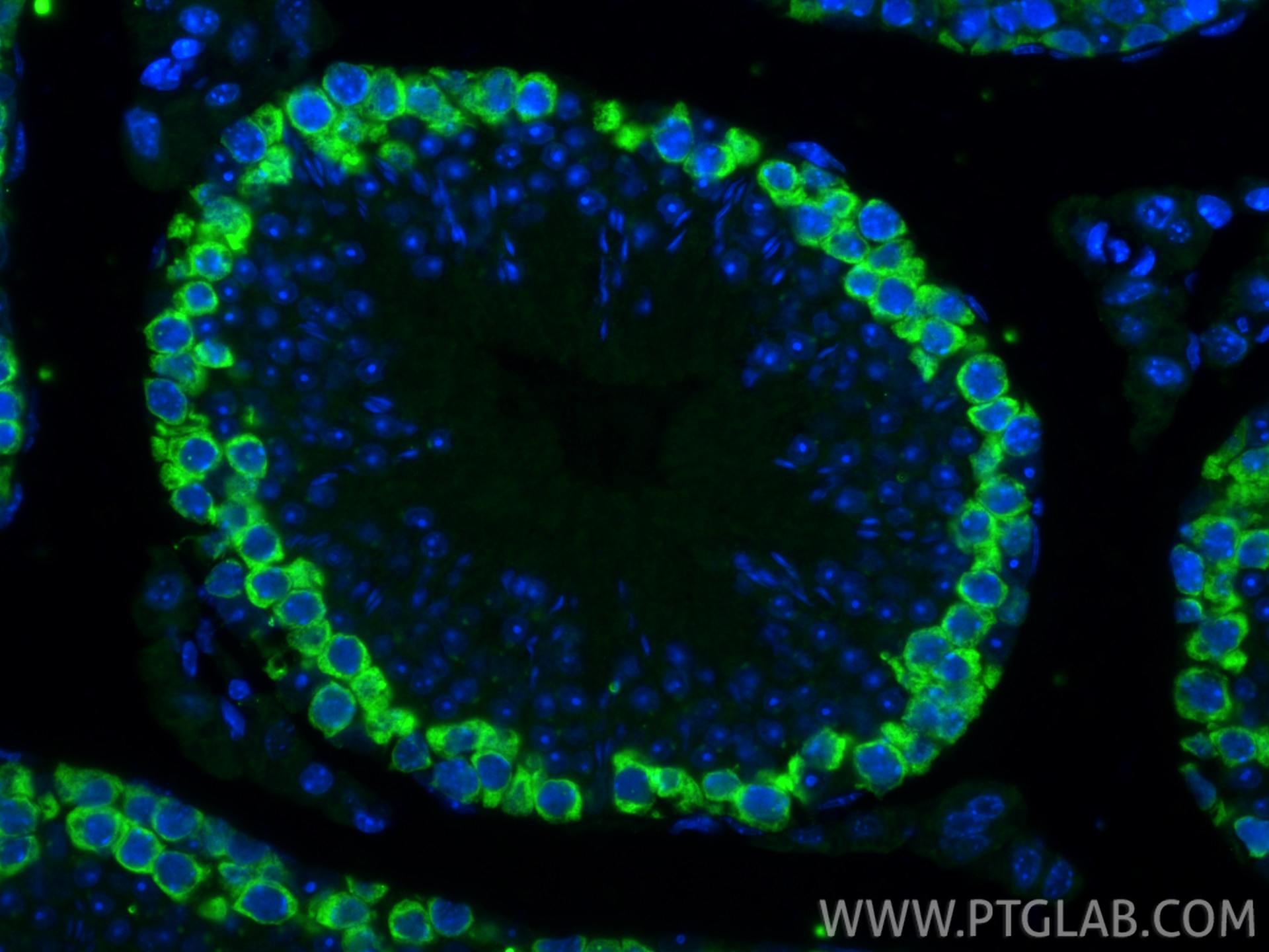 IF Staining of mouse testis using RMX00077 Immunofluorescence (IF) / fluorescent staining of mouse testis tissue using Multi-rAb® DAZL Multi-Recombinant antibody (RMX00077)