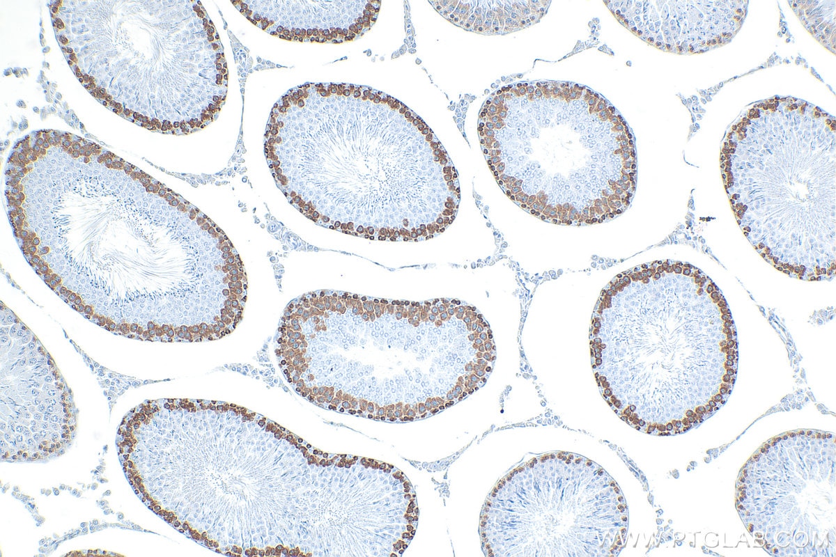 IHC staining of rat testis using RMX00077 Immunohistochemistry (IHC) staining of rat testis tissue using Multi-rAb® DAZL Multi-Recombinant antibody (RMX00077)