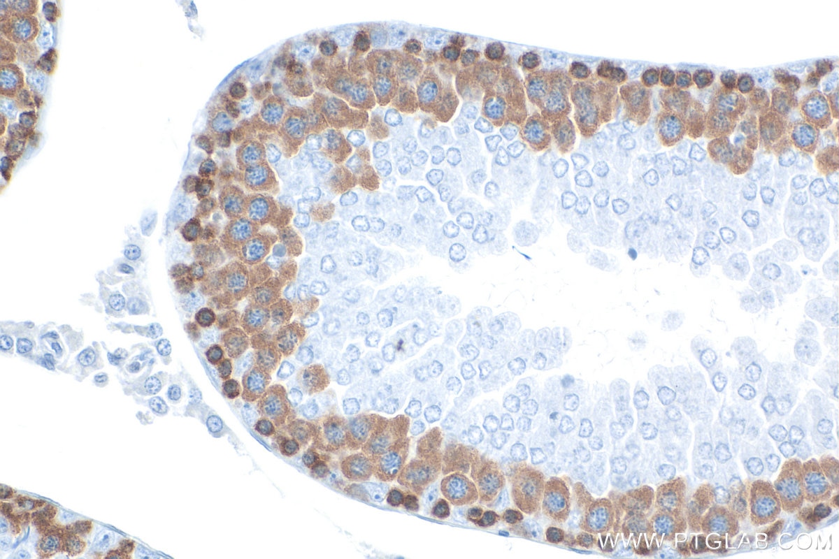 IHC staining of rat testis using RMX00077 Immunohistochemistry (IHC) staining of rat testis tissue using Multi-rAb® DAZL Multi-Recombinant antibody (RMX00077)