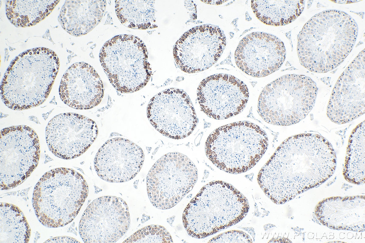 IHC staining of mouse testis using RMX00077 Immunohistochemistry (IHC) staining of mouse testis tissue using Multi-rAb® DAZL Multi-Recombinant antibody (RMX00077)
