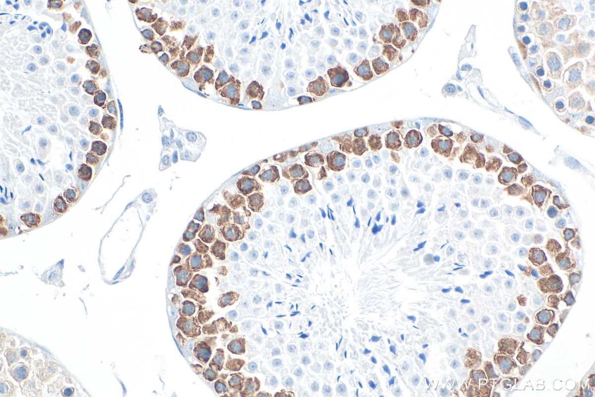 IHC staining of mouse testis using RMX00077 Immunohistochemistry (IHC) staining of mouse testis tissue using Multi-rAb® DAZL Multi-Recombinant antibody (RMX00077)
