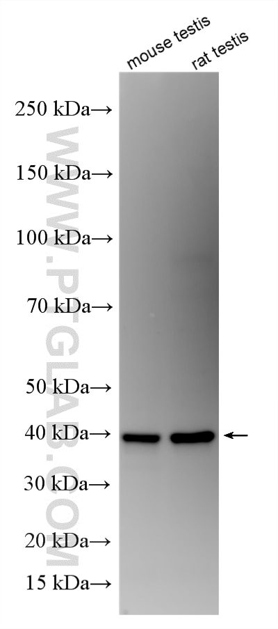 WB analysis using RMX00077 Western Blot (WB) analysis of various lysates using Multi-rAb® DAZL Multi-Recombinant antibody (RMX00077)