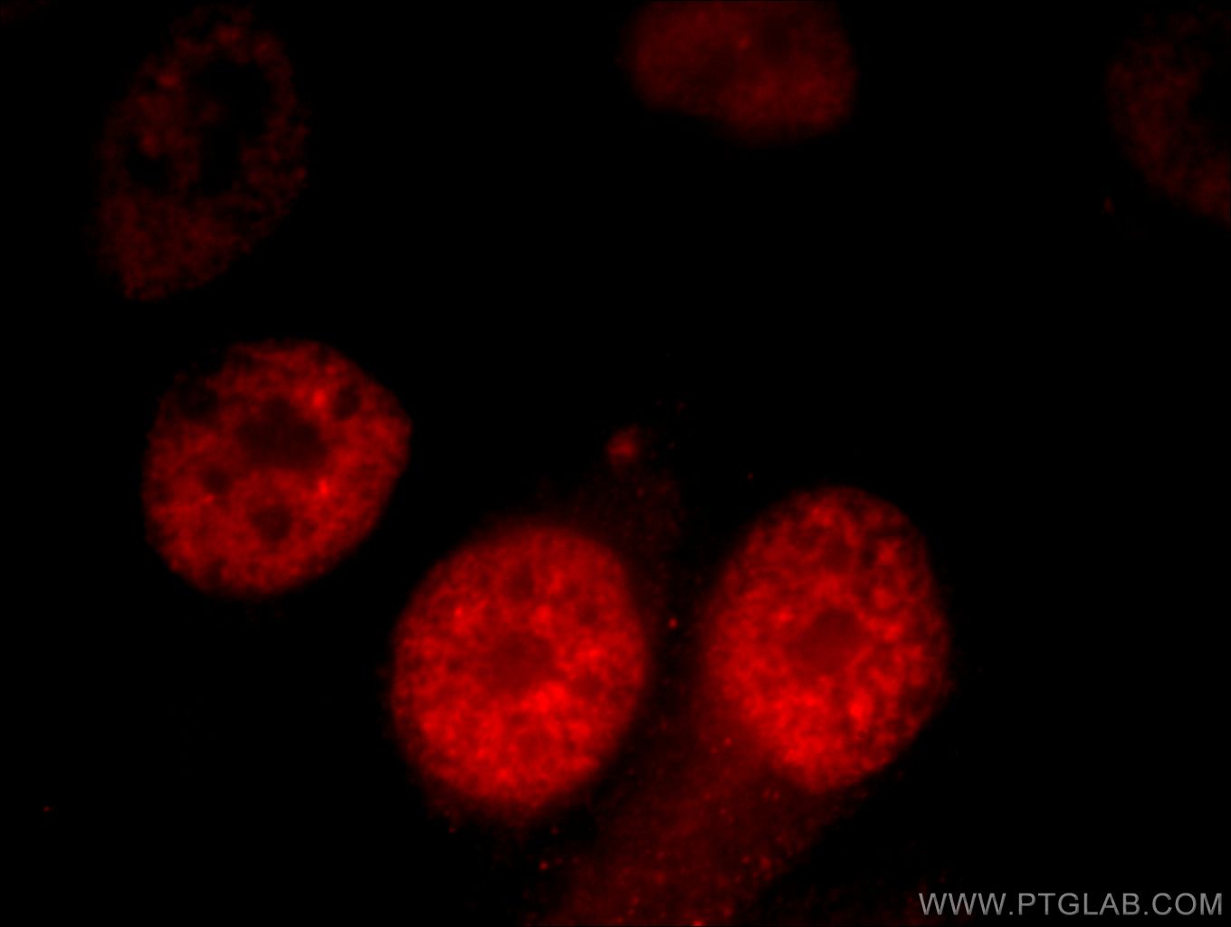 Immunofluorescence (IF) / fluorescent staining of HepG2 cells using CCAR2 Polyclonal antibody (22638-1-AP)