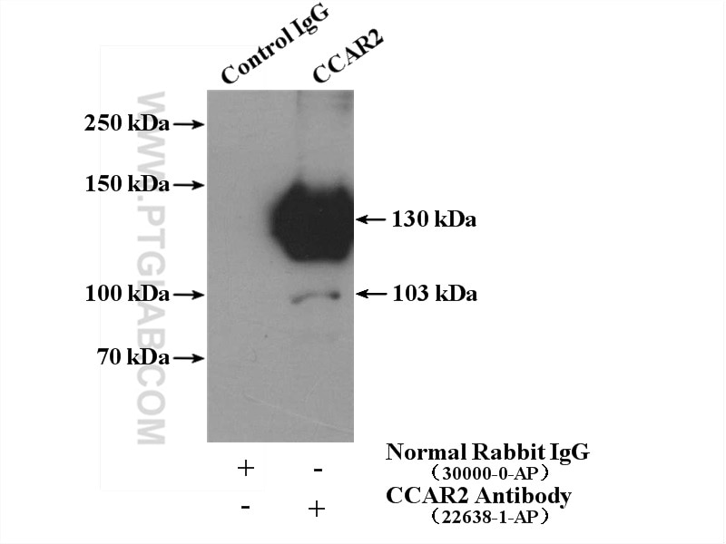 Immunoprecipitation (IP) experiment of mouse brain tissue using CCAR2 Polyclonal antibody (22638-1-AP)