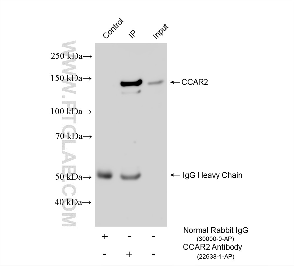 Immunoprecipitation (IP) experiment of mouse brain tissue using CCAR2 Polyclonal antibody (22638-1-AP)