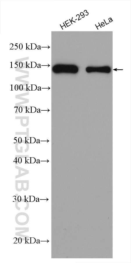 Western Blot (WB) analysis of various lysates using CCAR2 Polyclonal antibody (22638-1-AP)