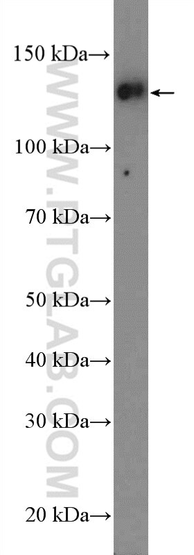 Western Blot (WB) analysis of HeLa cells using CCAR2 Polyclonal antibody (22638-1-AP)