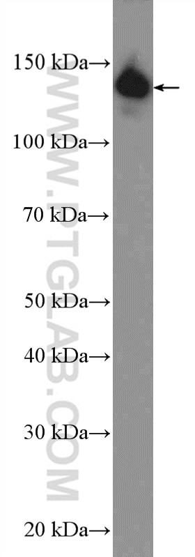 Western Blot (WB) analysis of HEK-293 cells using CCAR2 Polyclonal antibody (22638-1-AP)