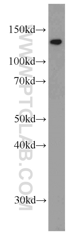 WB analysis of mouse brain using 22638-1-AP