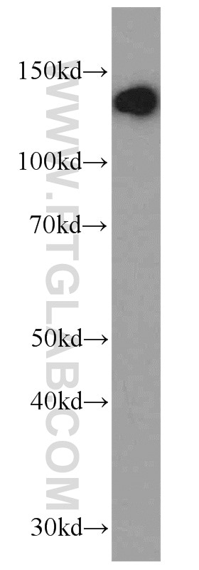 Western Blot (WB) analysis of MCF-7 cells using CCAR2 Polyclonal antibody (22638-1-AP)