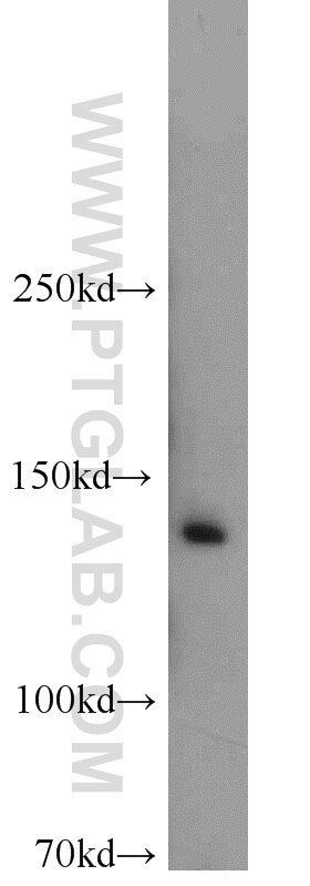 Western Blot (WB) analysis of rat brain tissue using CCAR2 Polyclonal antibody (22638-1-AP)