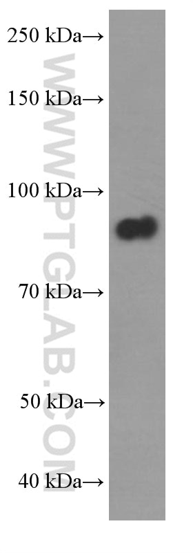 Western Blot (WB) analysis of fetal human brain tissue using BRINP1 Monoclonal antibody (60336-1-Ig)