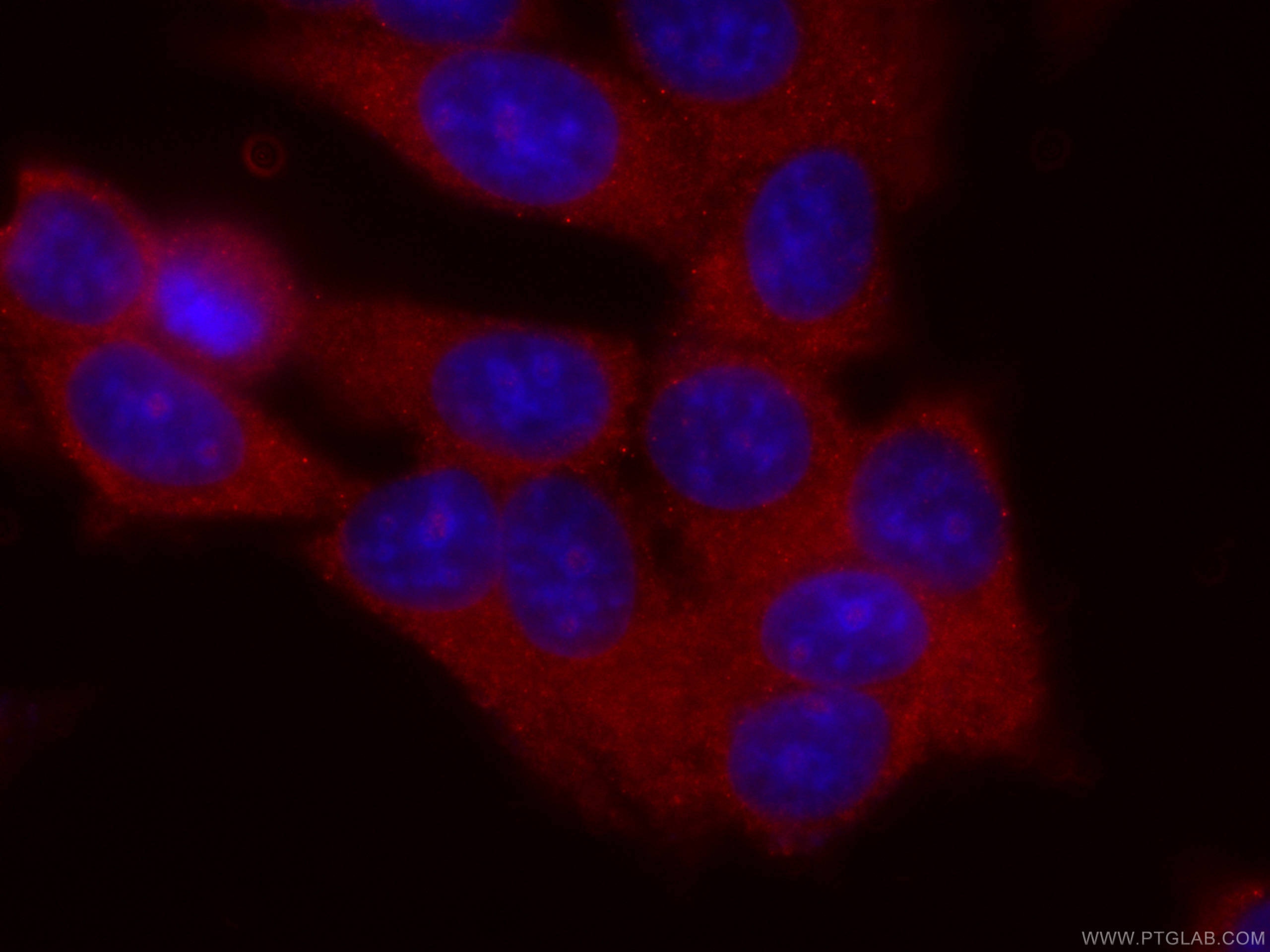 Immunofluorescence (IF) / fluorescent staining of MCF-7 cells using CoraLite®594-conjugated BRINP1 Monoclonal antibody (CL594-60336)