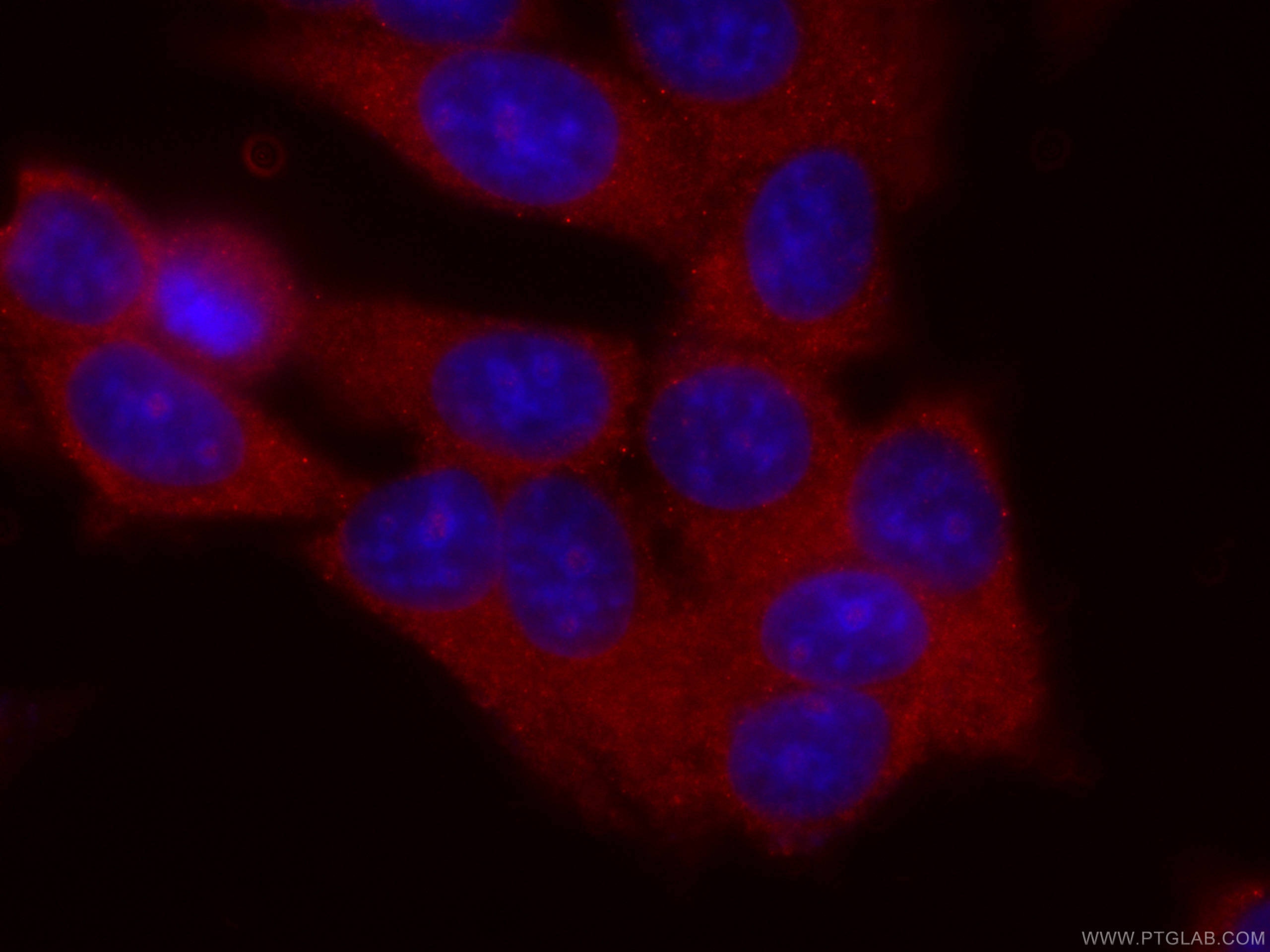 IF Staining of MCF-7 using CL594-60336