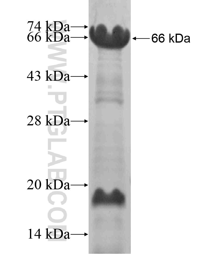 DBC1 fusion protein Ag18557 SDS-PAGE