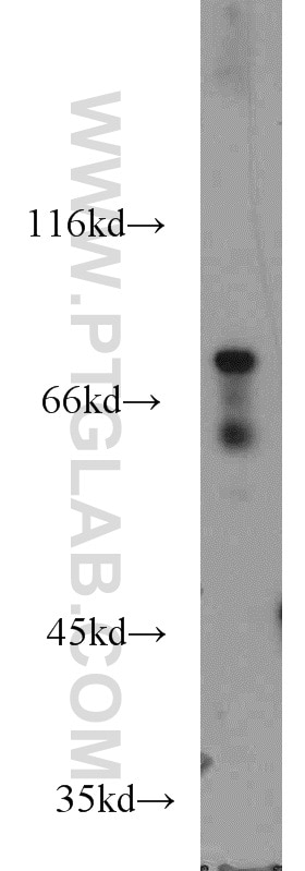 Western Blot (WB) analysis of NIH/3T3 cells using DBF4 Polyclonal antibody (13076-1-AP)