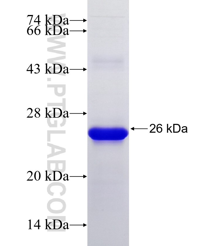 DBF4 fusion protein Ag30180 SDS-PAGE