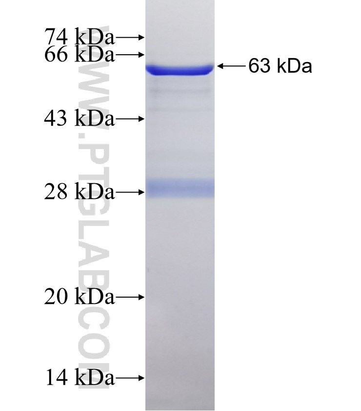 DBF4 fusion protein Ag3771 SDS-PAGE