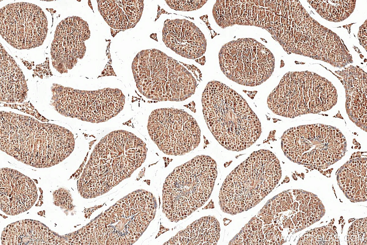 IHC staining of mouse testis using 26214-1-AP Immunohistochemistry (IHC) staining of mouse testis tissue using DBF4B Polyclonal antibody (26214-1-AP)