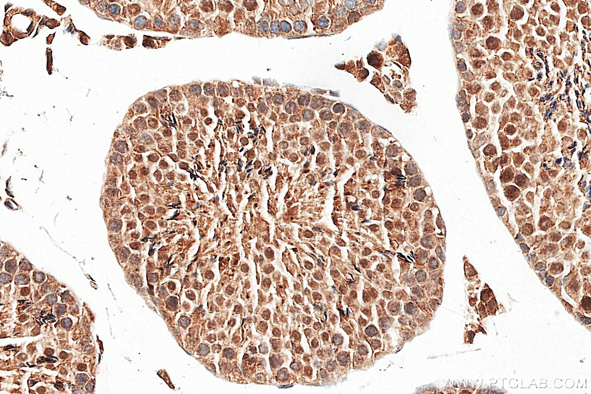 IHC staining of mouse testis using 26214-1-AP Immunohistochemistry (IHC) staining of mouse testis tissue using DBF4B Polyclonal antibody (26214-1-AP)