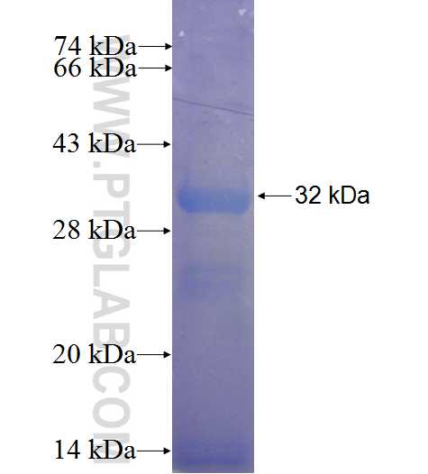 DBF4B fusion protein Ag23889 SDS-PAGE