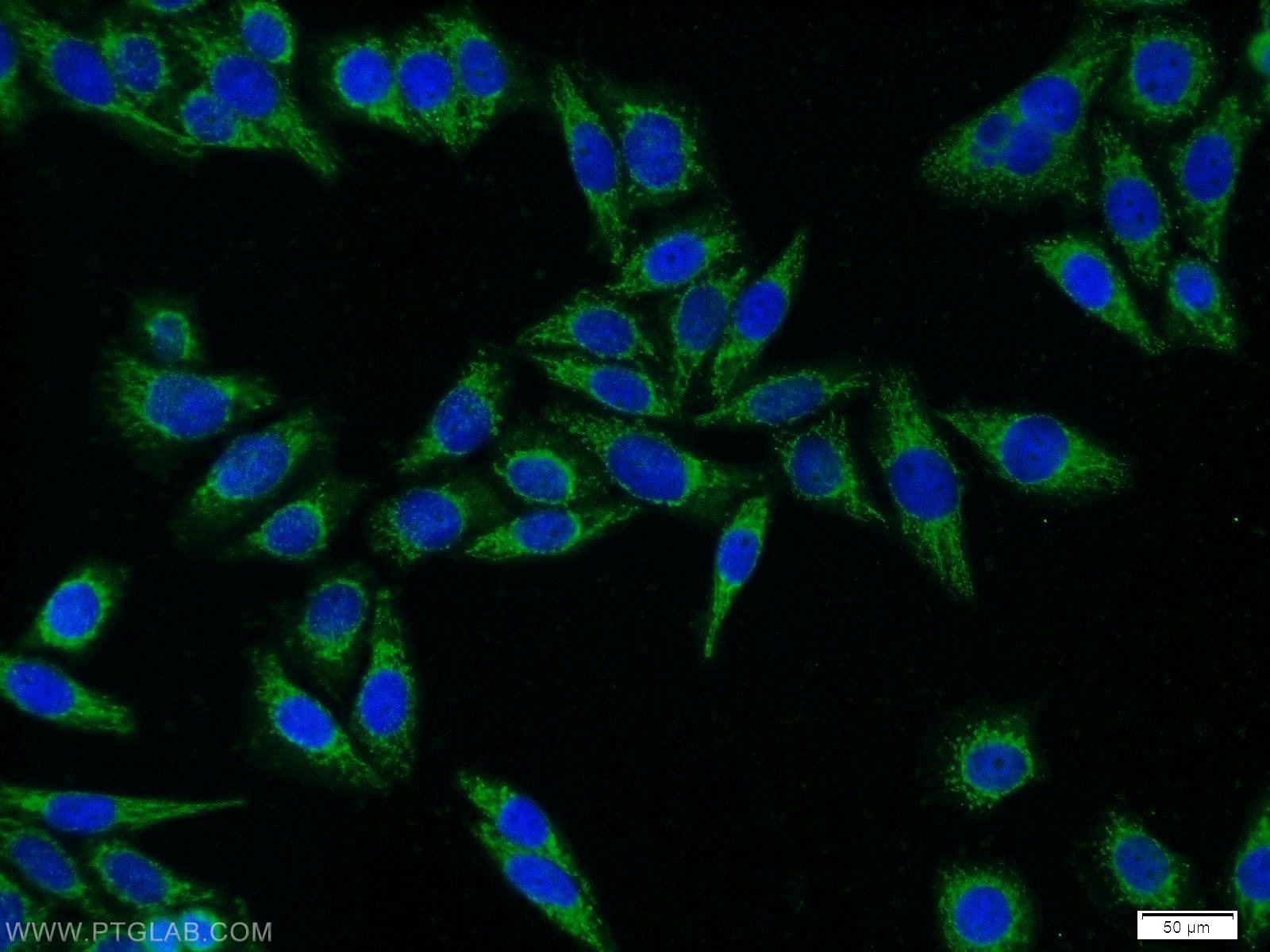 Immunofluorescence (IF) / fluorescent staining of HeLa cells using DBH Polyclonal antibody (10777-1-AP)