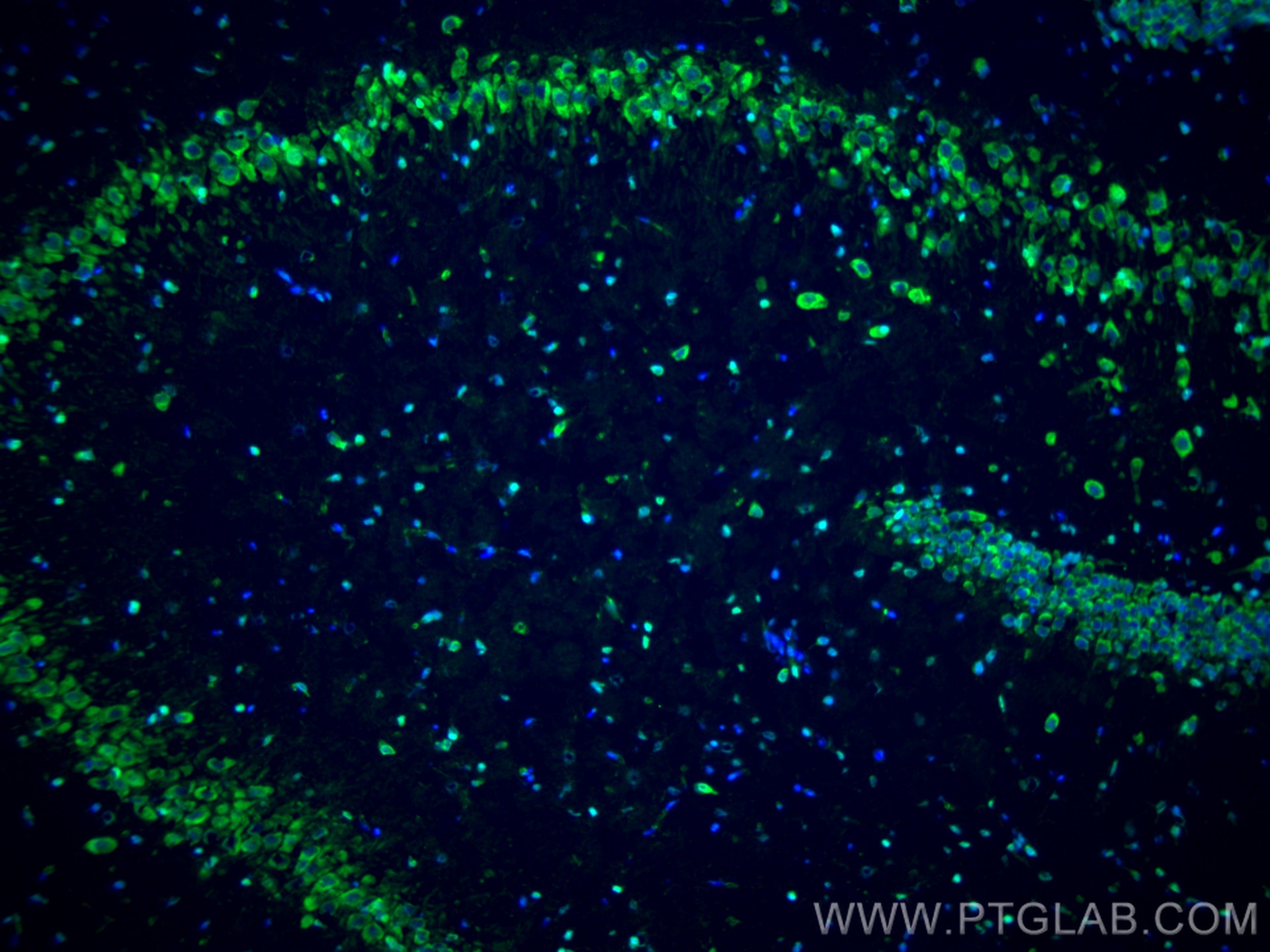 Immunofluorescence (IF) / fluorescent staining of rat brain tissue using DBH Polyclonal antibody (10777-1-AP)