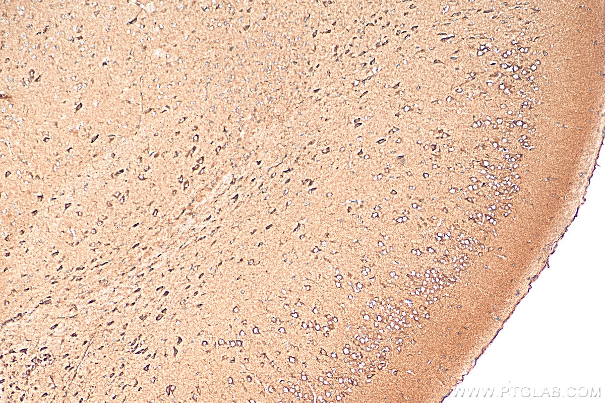 Immunohistochemistry (IHC) staining of mouse brain tissue using DBH Polyclonal antibody (10777-1-AP)