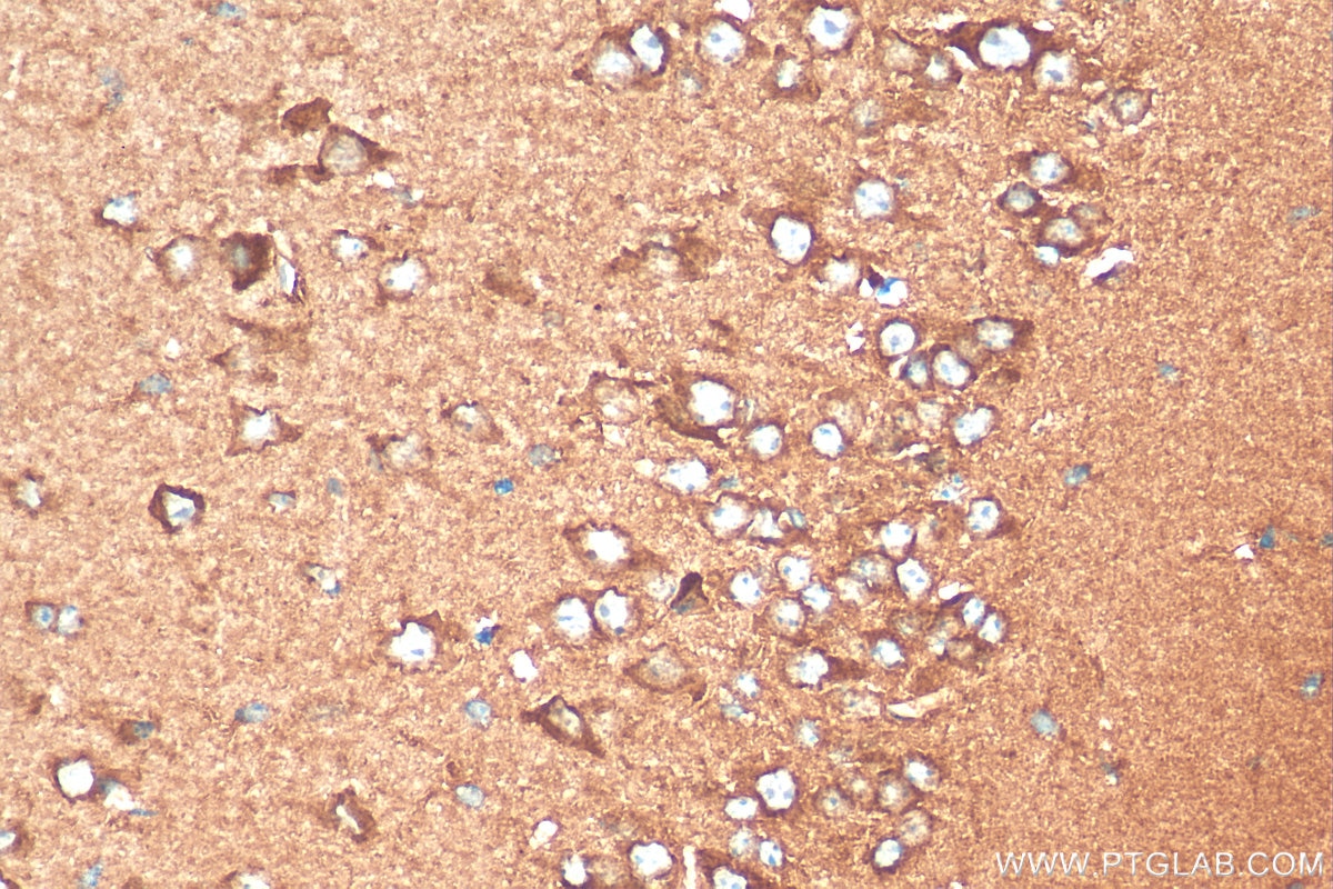 Immunohistochemistry (IHC) staining of mouse brain tissue using DBH Polyclonal antibody (10777-1-AP)