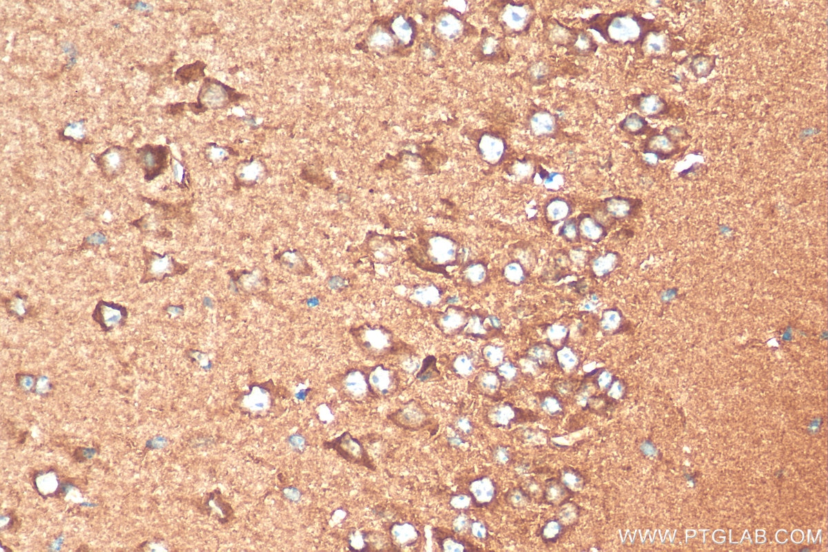 IHC staining of mouse brain using 10777-1-AP