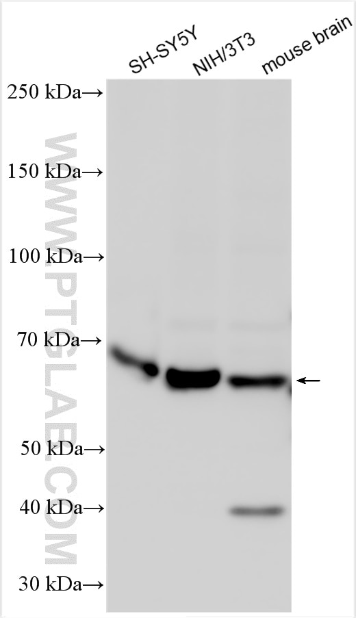 Western Blot (WB) analysis of various lysates using DBH Polyclonal antibody (10777-1-AP)