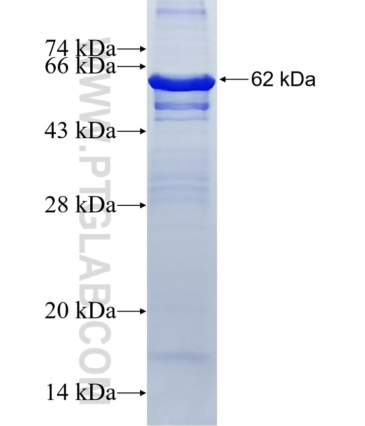 DBH fusion protein Ag1196 SDS-PAGE