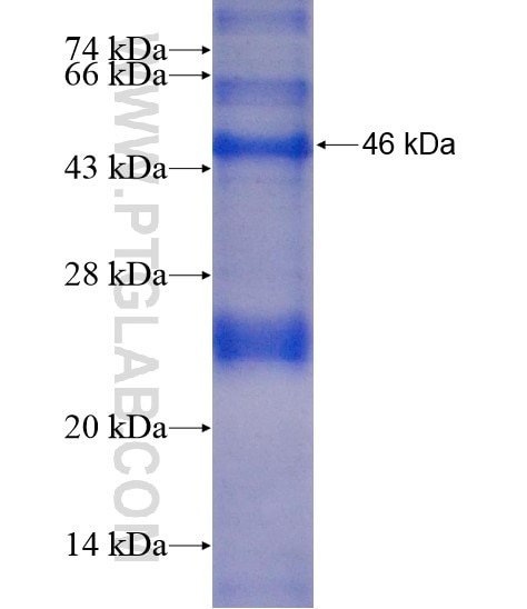 DBH fusion protein Ag21246 SDS-PAGE