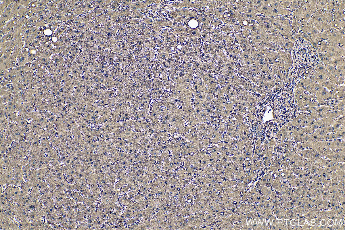 IHC staining of human liver using 14490-1-AP Immunohistochemistry (IHC) staining of human liver tissue using ACBP/DBI Polyclonal antibody (14490-1-AP)