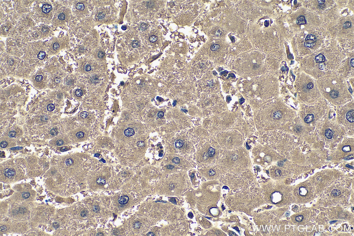 IHC staining of human liver using 14490-1-AP Immunohistochemistry (IHC) staining of human liver tissue using ACBP/DBI Polyclonal antibody (14490-1-AP)
