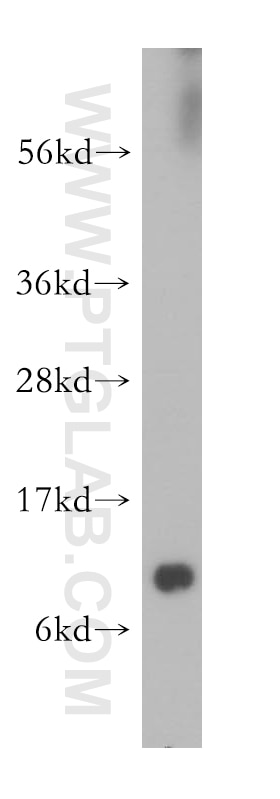 Western Blot (WB) analysis of human liver tissue using DBI Polyclonal antibody (14490-1-AP)