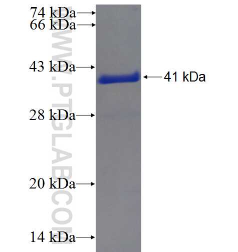 DBI fusion protein Ag5891 SDS-PAGE