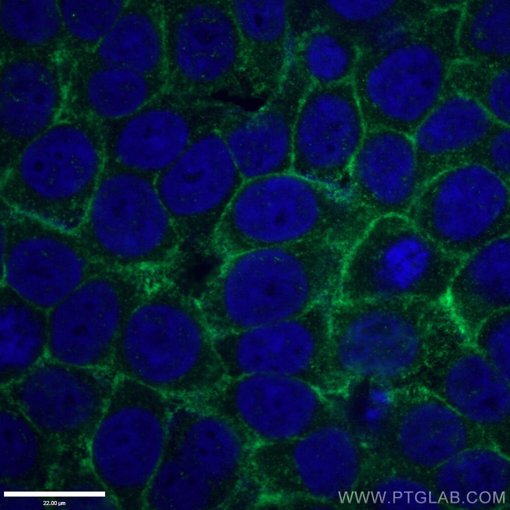 Immunofluorescence (IF) / fluorescent staining of HepG2 cells using Drebrin Polyclonal antibody (10260-1-AP)